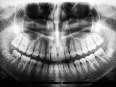 Common Dental Issues and How to Avoid Them